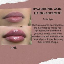 Lip