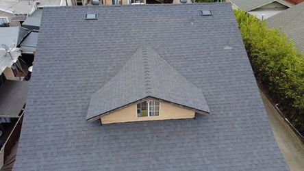 Shingles