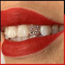 Jewel 💎 For Your Teeth 💎💎💎