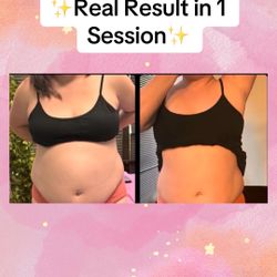 Body Sculpting