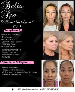 HIFU treatment morpheous 8.  Tatoo removal