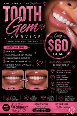 Tooth gem install
