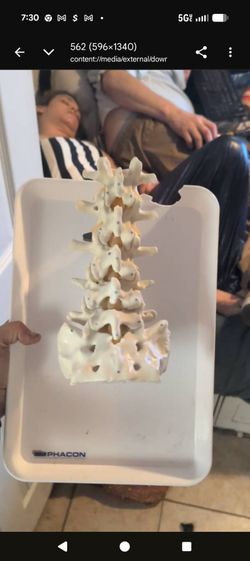 Phacon Spine Anatomical Model