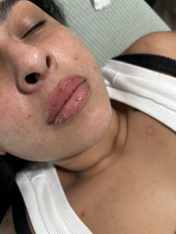 Lips