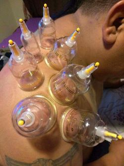 Dolor de espalda estres yo te puedo ayudar masages terapeuticos.ventosas frÃas y calientes masages y piedras calientes para estrés