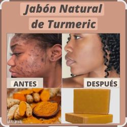 Tumeric Soap/ Jabon De Curcuma 