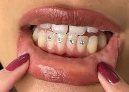 Tooth gems 💎 