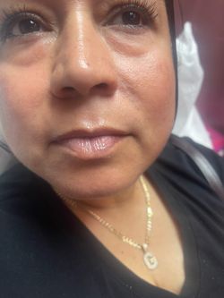 Lip filler