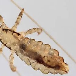 Lice removal
