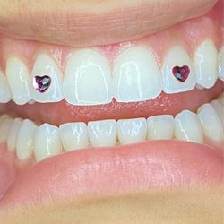 Tooth Gems 💎