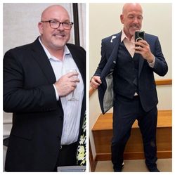 Weight Loss Equipment
