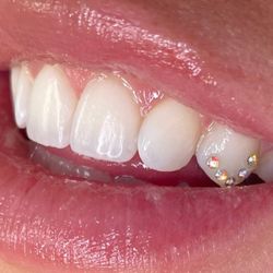 TOOTH GEM