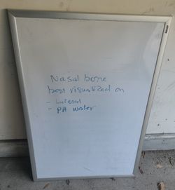 White board