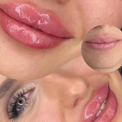 Add Volume Today ✅Long Lasting lips 🫦