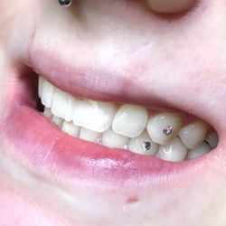 Tooth Gem