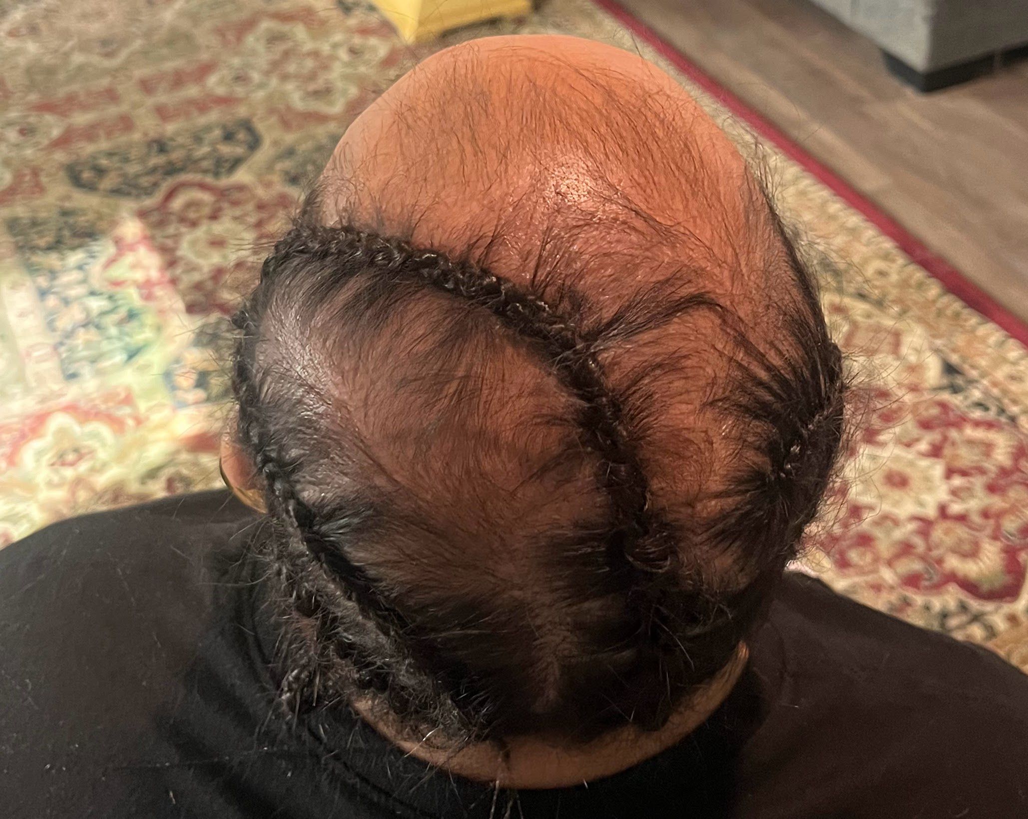 Hair Thinning? Inbox Me I Can Help
