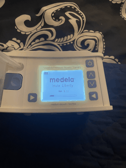 2023 Medela Invia Liberty NPWT Negative Pressure Wound Therapy System