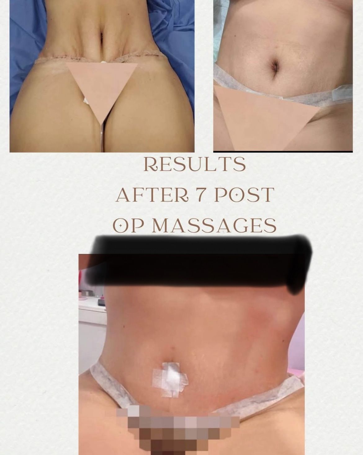 Post Op Massages