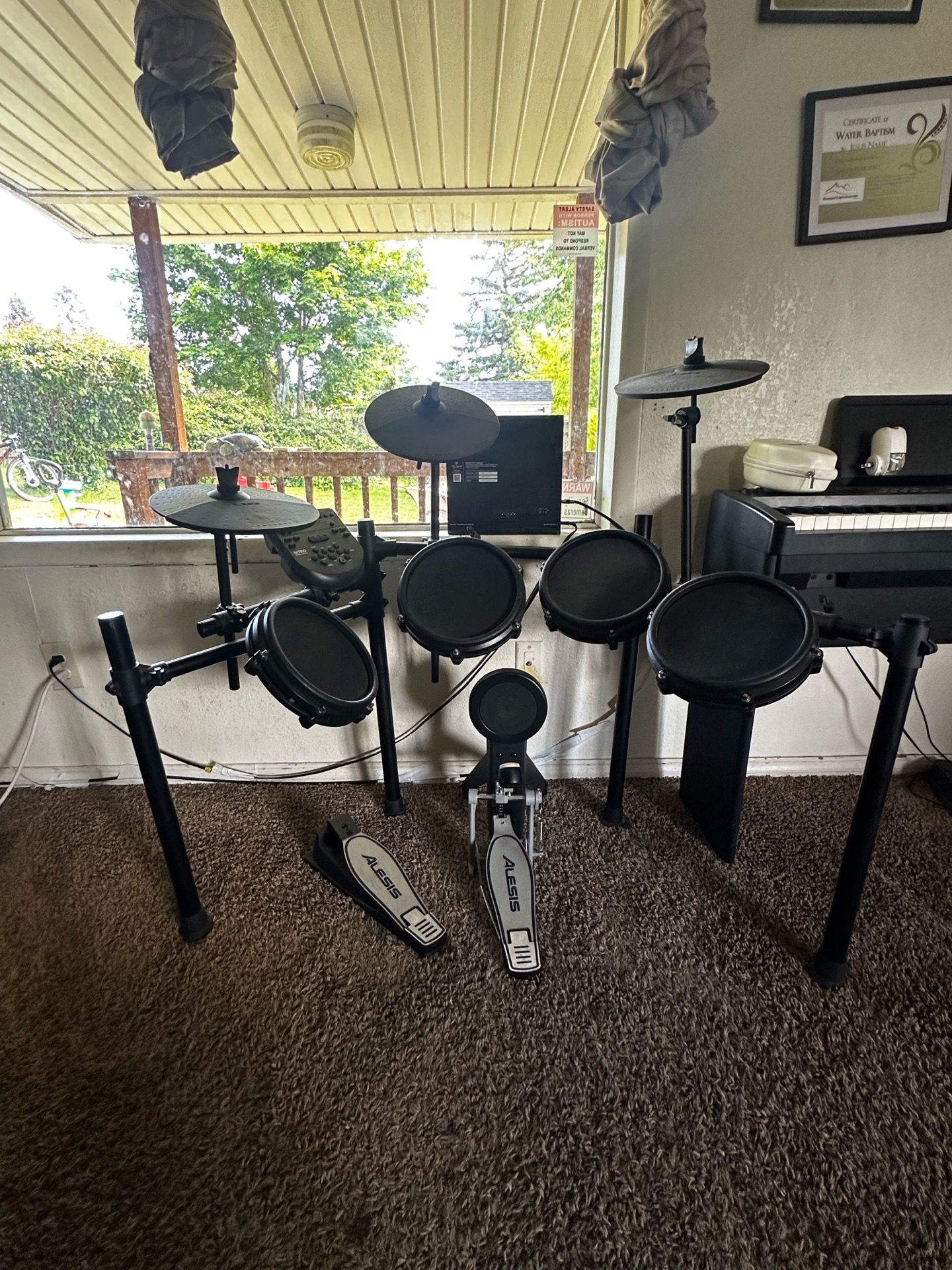 Alesis electric drum set
