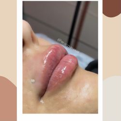 Lips