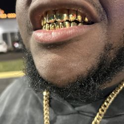 Custom Grillz NPG Special Orlando Florida