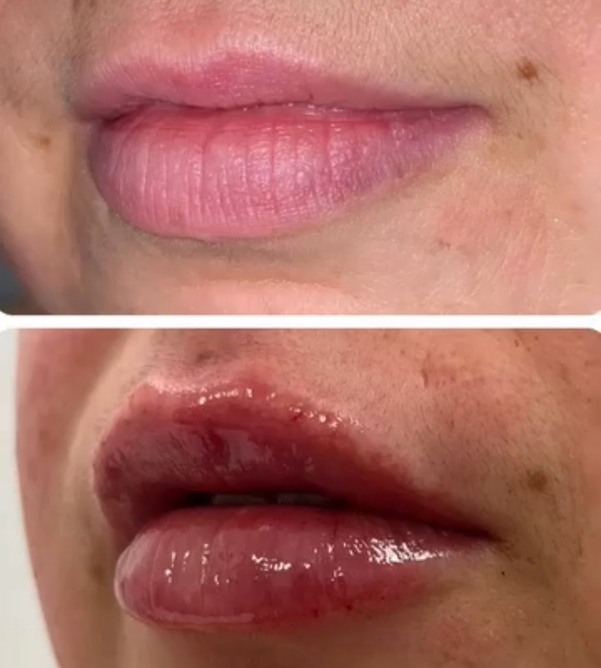 Lip gloss