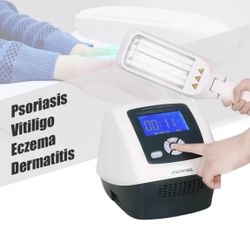 UV Light Therapy
