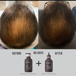 Hair Thining??