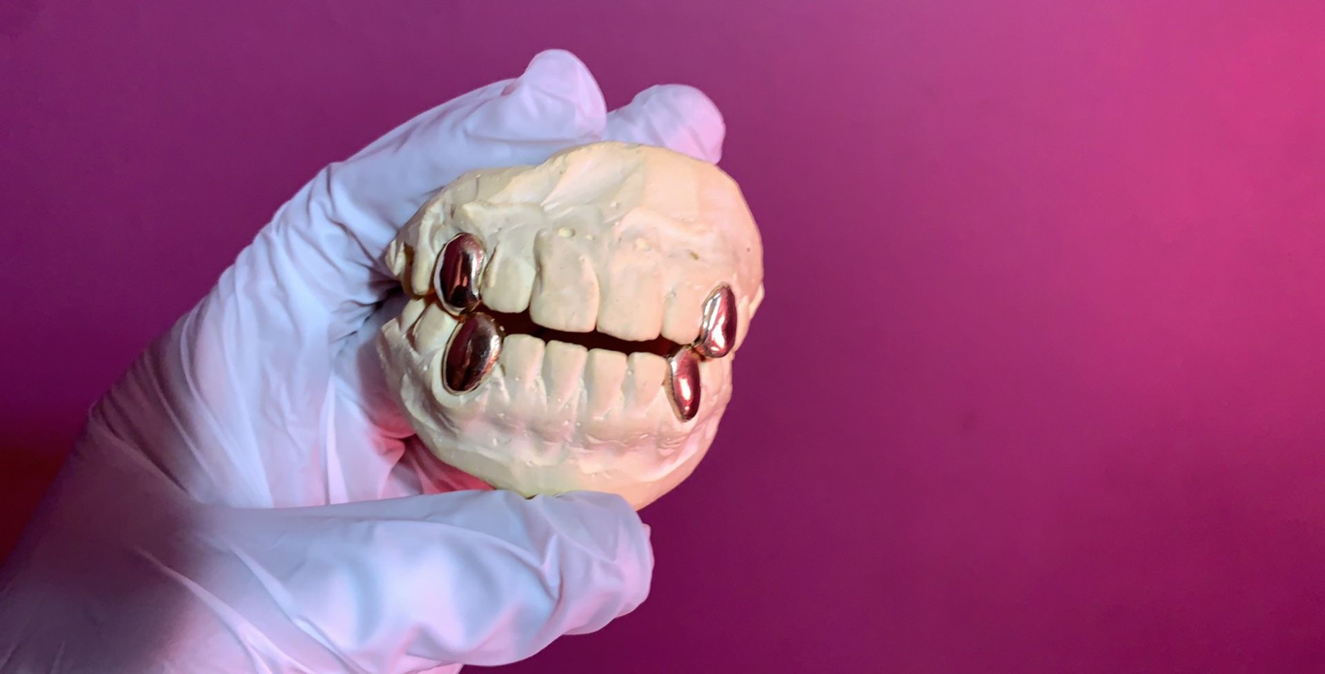 Custom gold grillz/ gold teeth