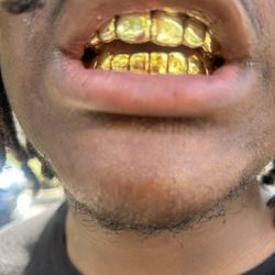 Wall To Wall Gold Grillz - Orlando Florida Mobile Jeweler
