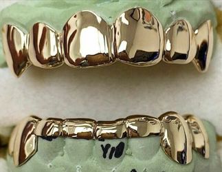 Gold teeth $450