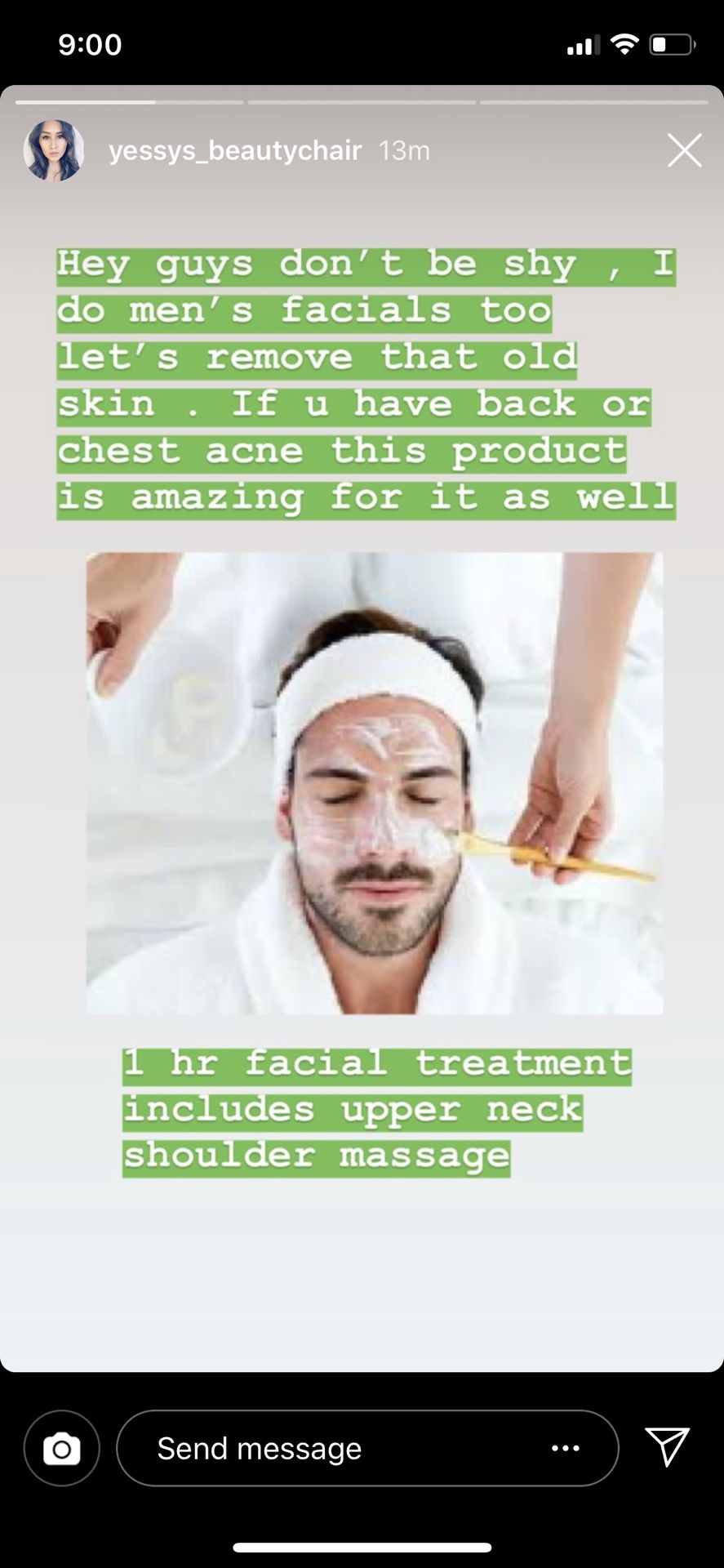 Kinetic Dermabrasion Facial equipment