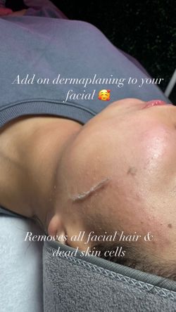 Dermaplaning Facial