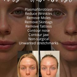 Lifestyles Luxuries.. Turn Back Time