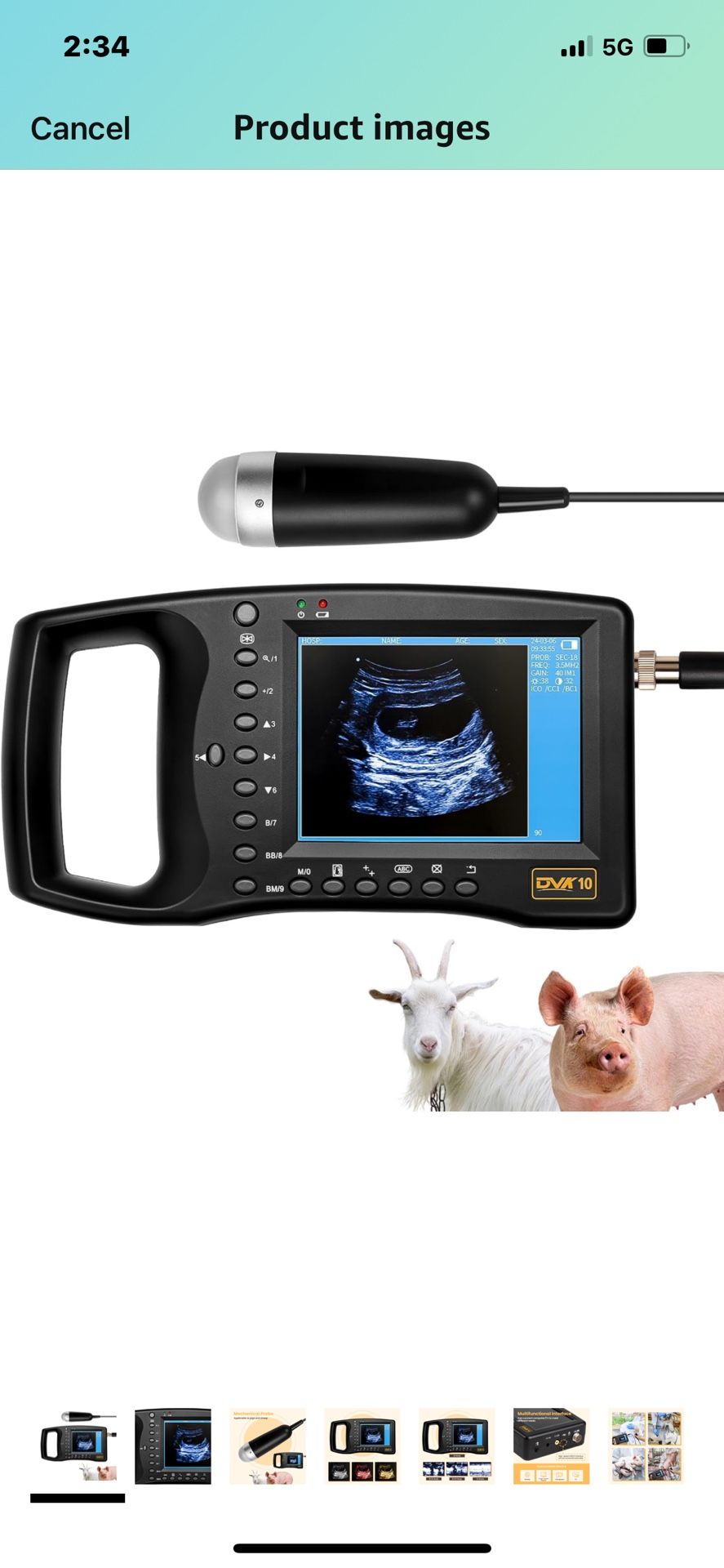 Sonogram Writing Machine Portable Ultrasound Machine for Pregnancy - Digital Sonogram Machine ...