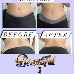 Lipo