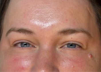 Brow Lamination