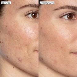 Sunday Riley Good Genes Serum NO TOP