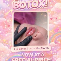 Especial a 6 la unidad no menos de 40 unidades líp filler