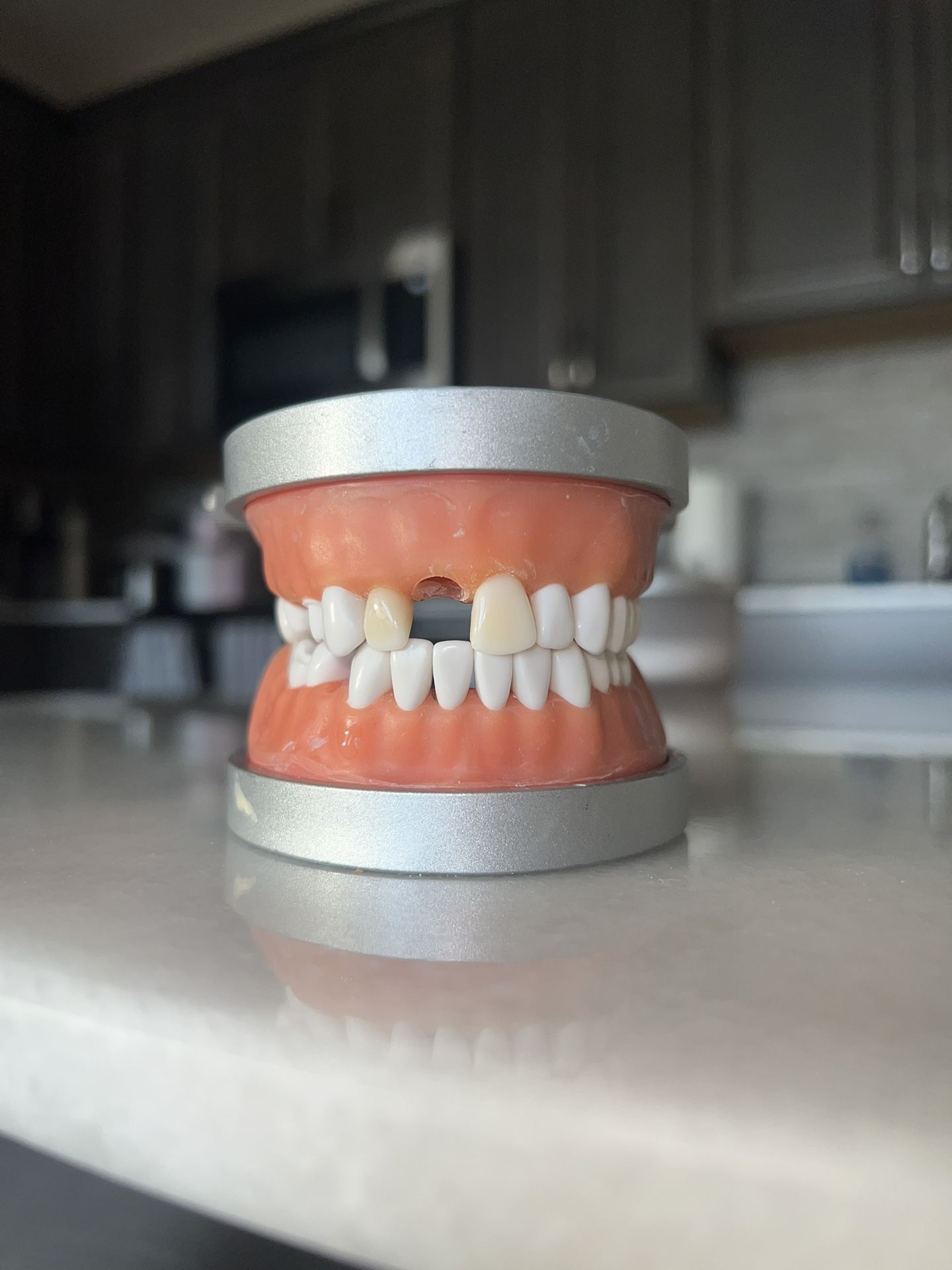 ModuPRO One MP_R320 Acadental Restoration Typodont