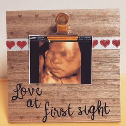 Ultrasound frame