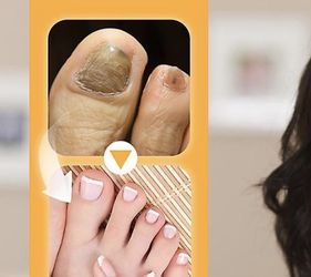 New 2 Pack Nail Defense Bee Venom Treatment Serum.  