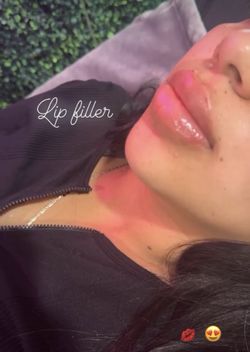Lips
