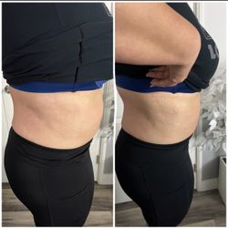 Lipo