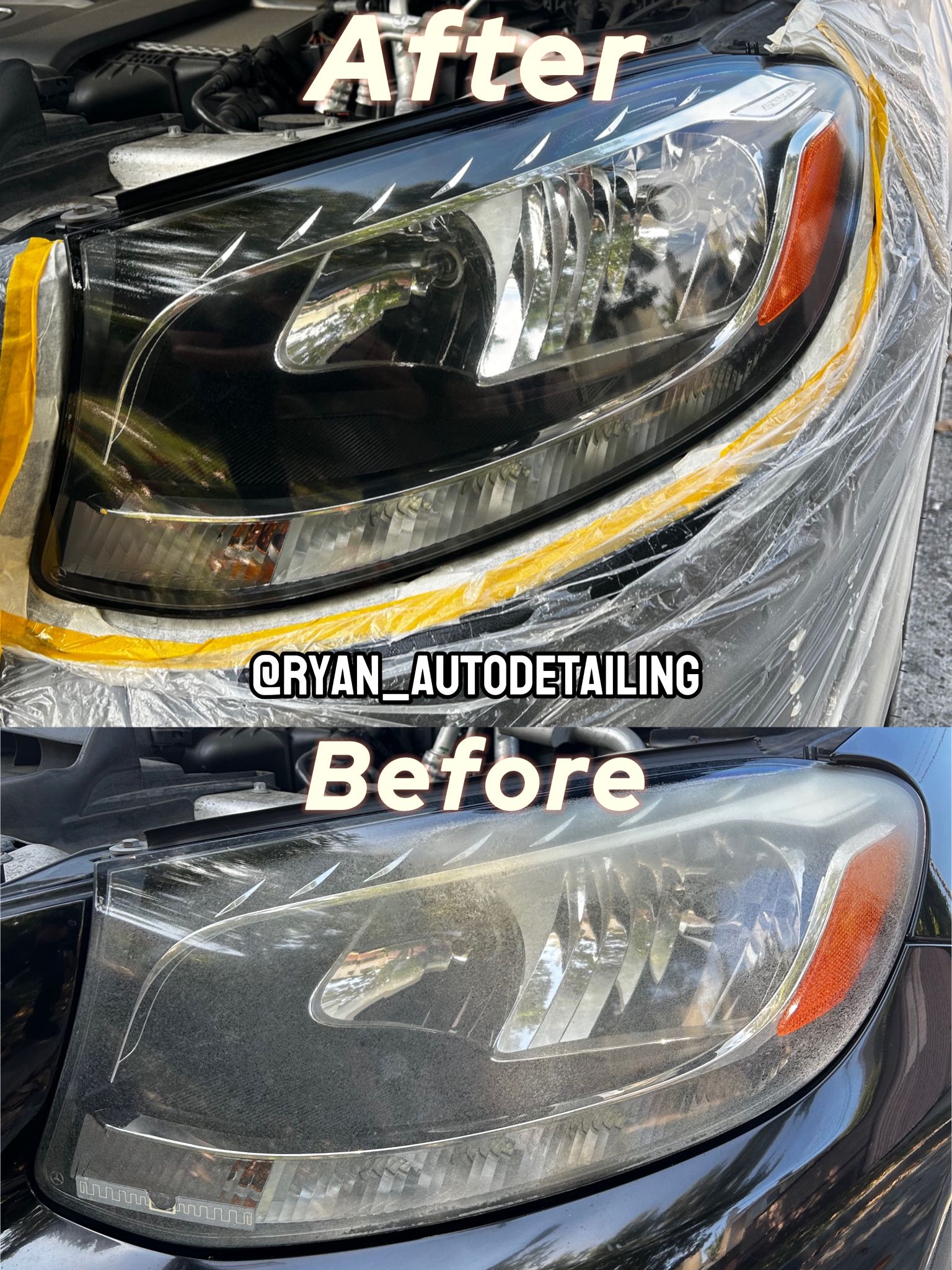 Headlight Kit