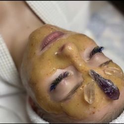 HydroJelly Facials 