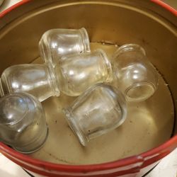 Cupping Jars For Pain Relief