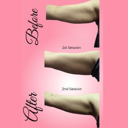 Bodyscupting