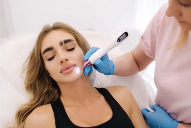 Skin Tag Removal Treatment 