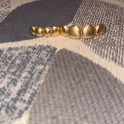 Gold Teeth 